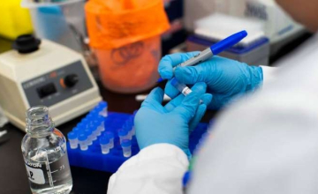  საქართველოში კორონავირუსით ინფიცირების 515 ახალი შემთხვევა დაფიქსირდა