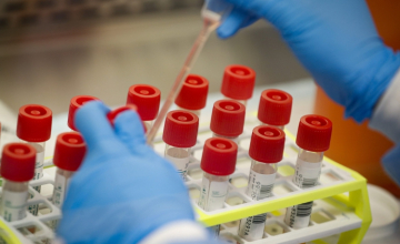 საქართველოში კორონავირუსით ინფიცირების 616 ახალი შემთხვევა დაფიქსირდა