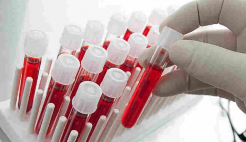 სამცხე-ჯავახეთში ბავშვების 32% სისხლში ტყვიის შემცველობა მომატებული აქვს - კვლევის შედეგები