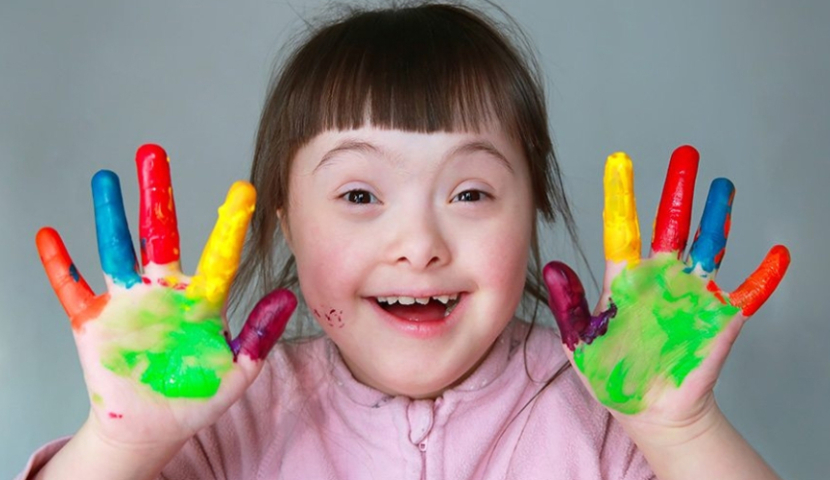 დღეს დაუნის სინდრომის საერთაშორისო დღეა