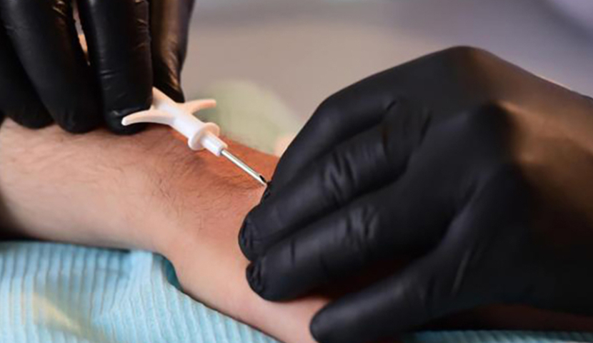 შემოიტანენ თუ არა საქართველოში კანქვეშა ჩიპებს?