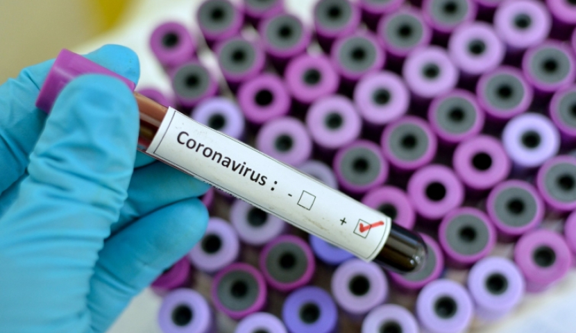 კორონავირუსზე შემოწმების PCR ცნობა ან 14 დღიანი სავალდებულო კარანტინი - ახალი შეზღუდვები საქართველოში შემოსვლისას