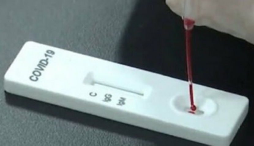 საქართველოში კორონავირუსით ინფიცირების 13 737 ახალი შემთხვევა დაფიქსირდა