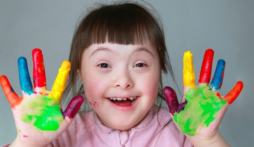 დღეს დაუნის სინდრომის მქონე პირთა საერთაშორისო დღეა